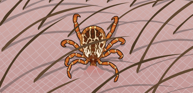 Tick